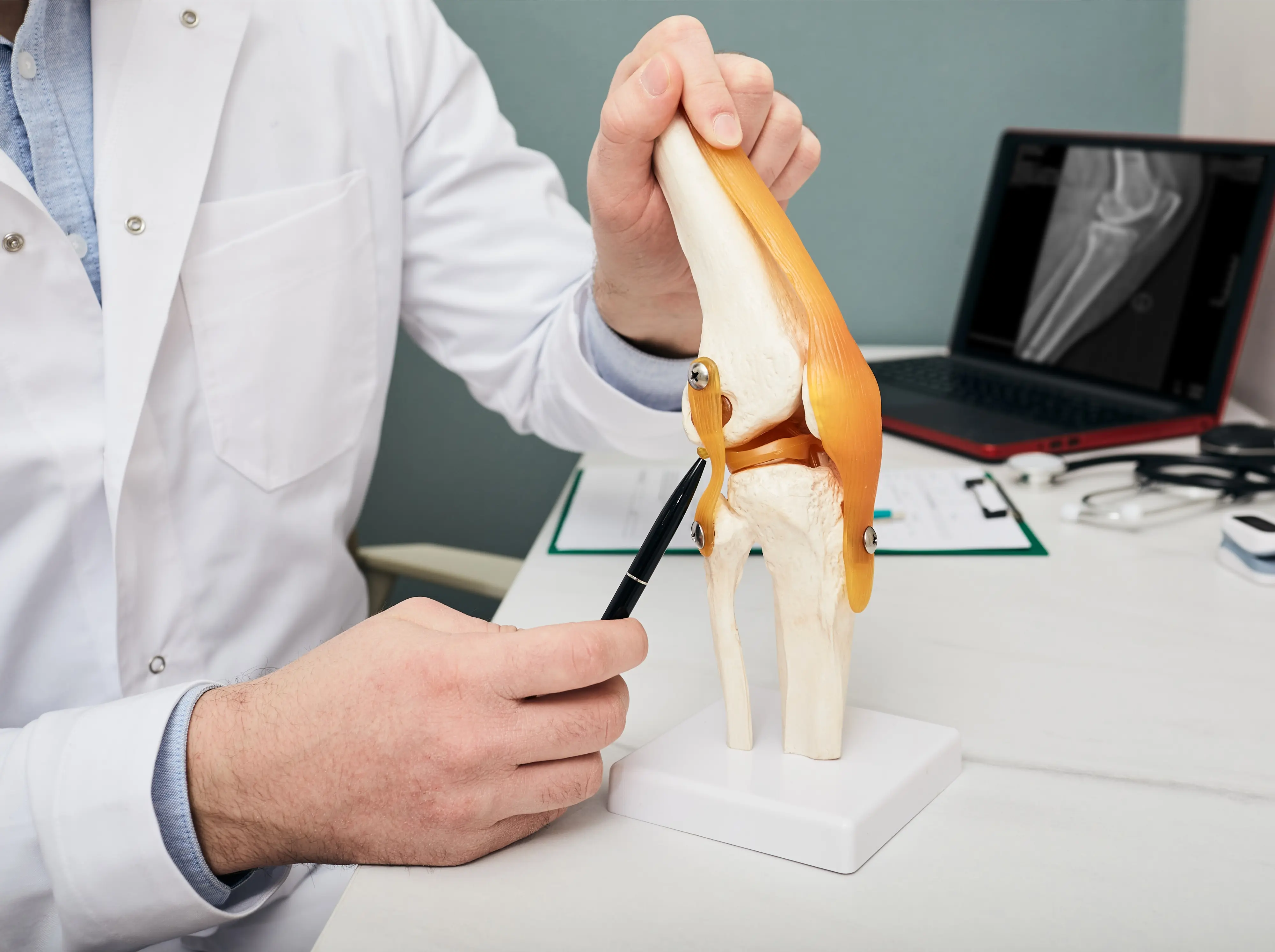 Ligamentos